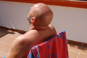 Bald-man-sitting-in-the-sun